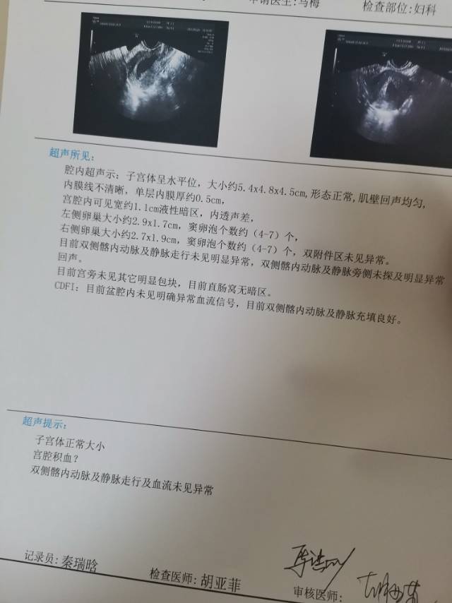 1月11号做的无痛人流一个星期后复查没流干净