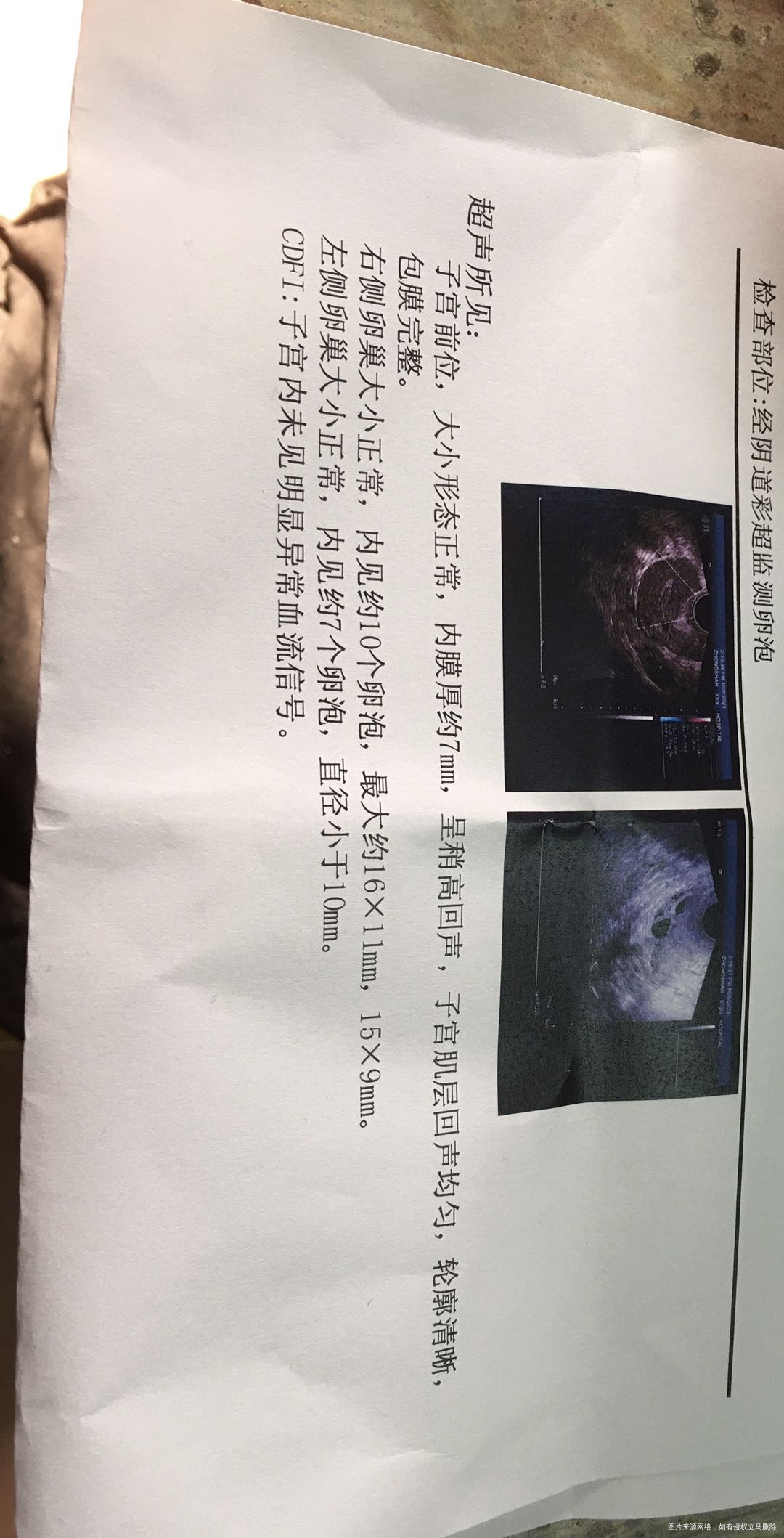 促排绒促后月经第十七天卵泡发育小发育正常吗受