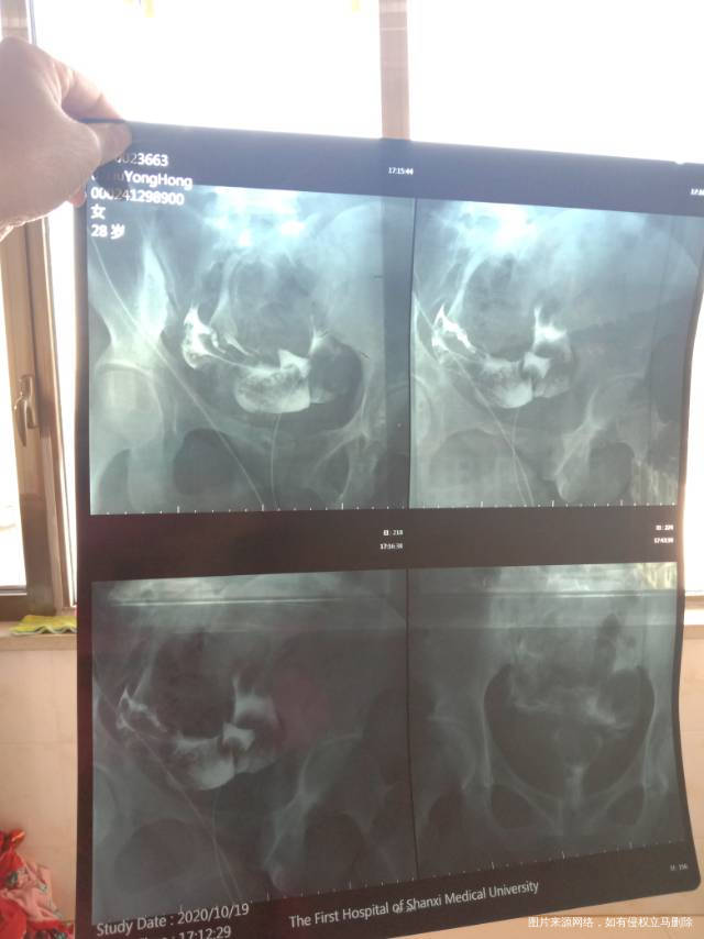 结婚5年一直检查原因不明就是怀孕怀不上不知道