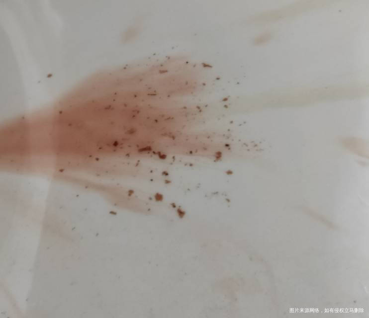 鲜胚移植失败医生让做宫腔镜检查检查是内膜息肉