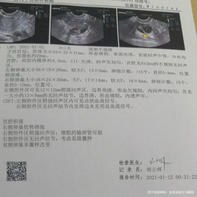 这月还有怀孕的希望吗请医生指导