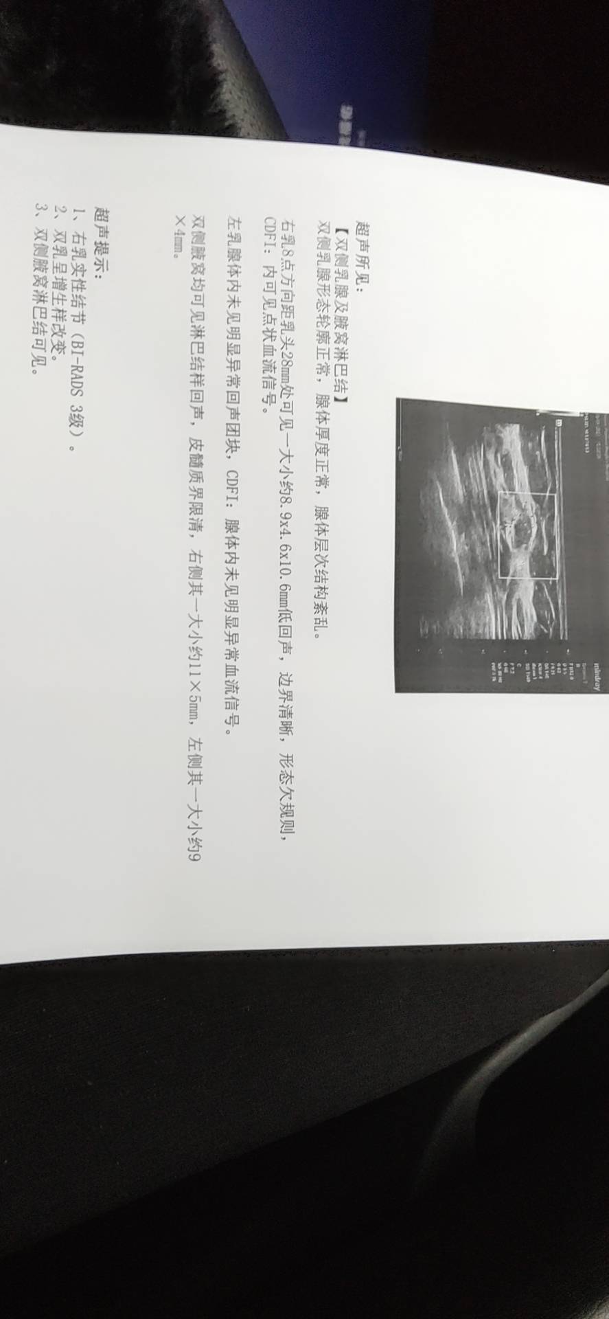 医生您好想问一下我这个结节准备怀孕的话有没有