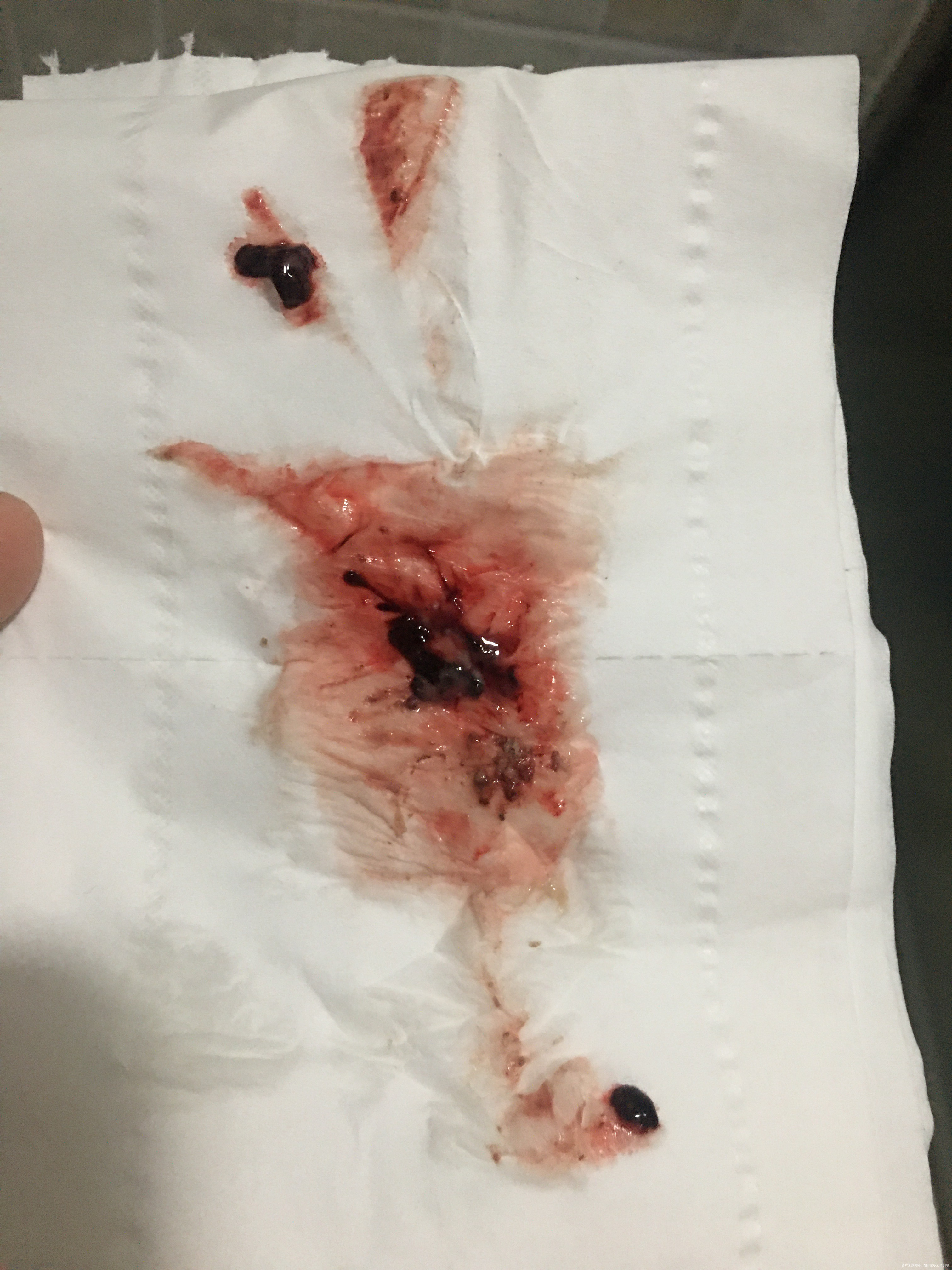 试管早孕7周双胎目前每日用药阴道雪诺酮注射肝