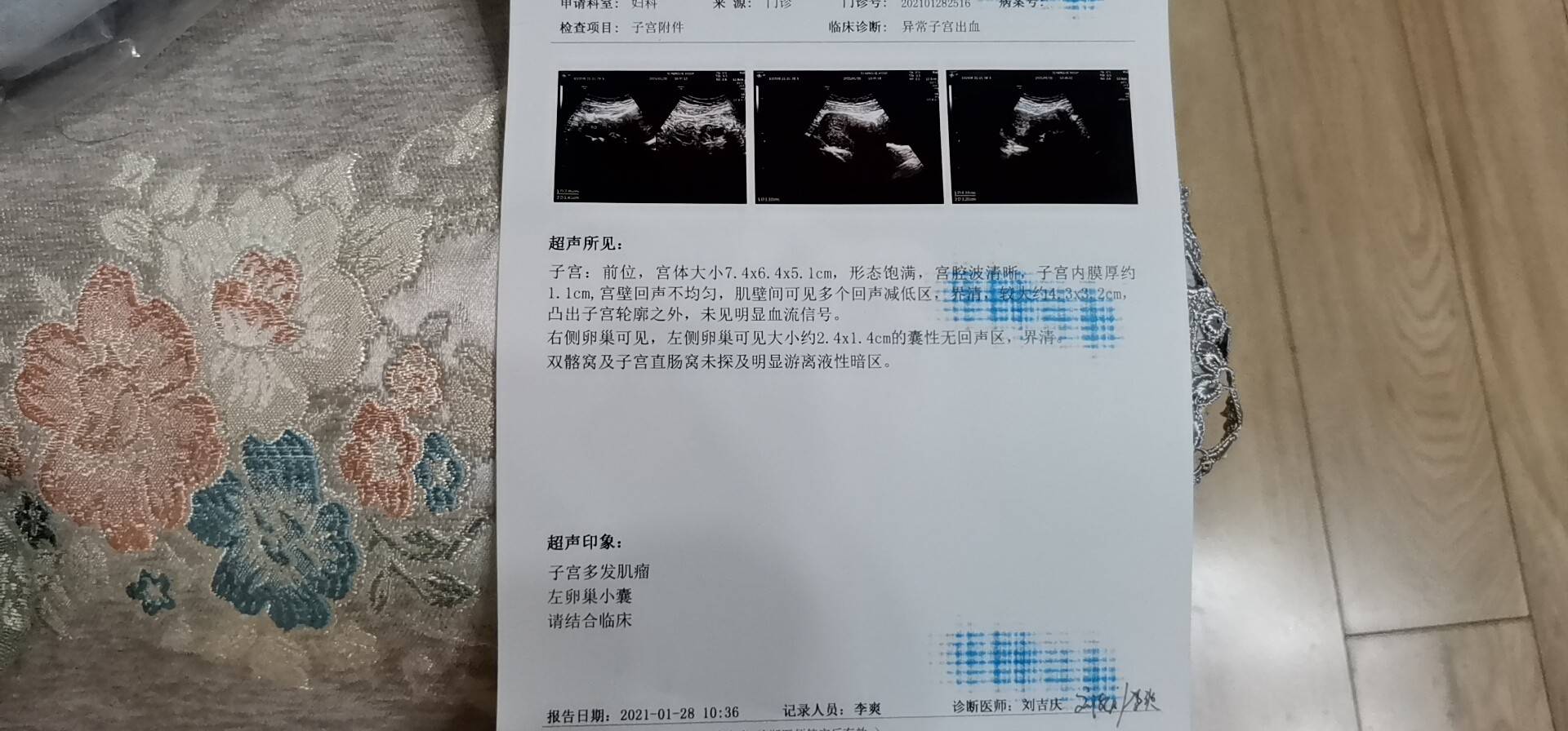 您好月经来33天了前20天断断续续后10天多