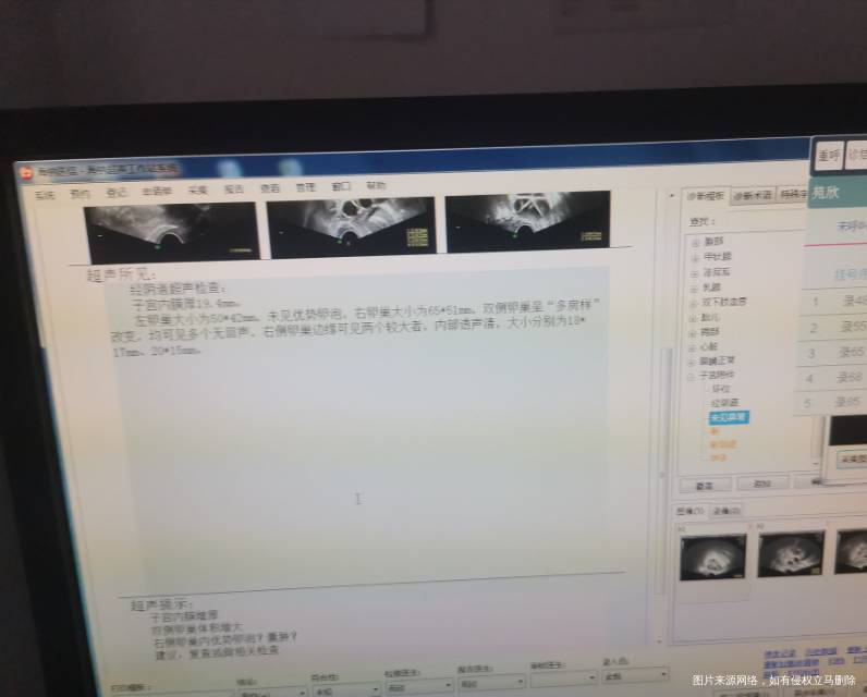 多囊促排吃了五天来曲卵泡没涨又打了五针尿促1