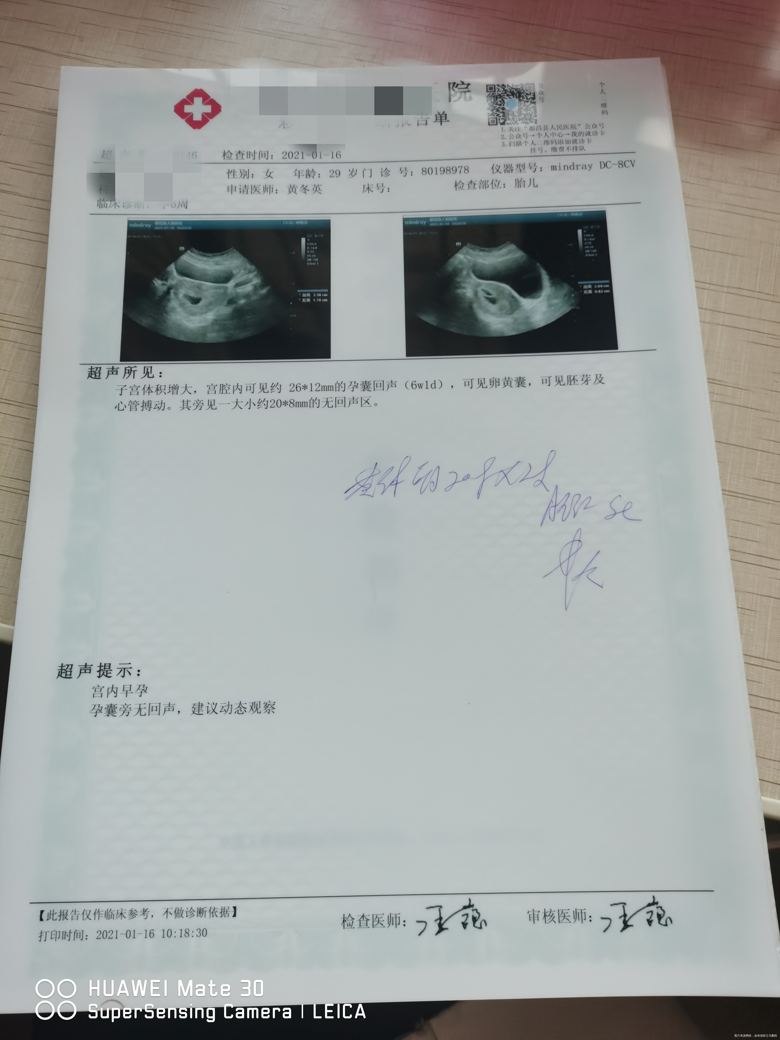 吃午饭木头门门突然骤落打压到头部我坐的那个凳