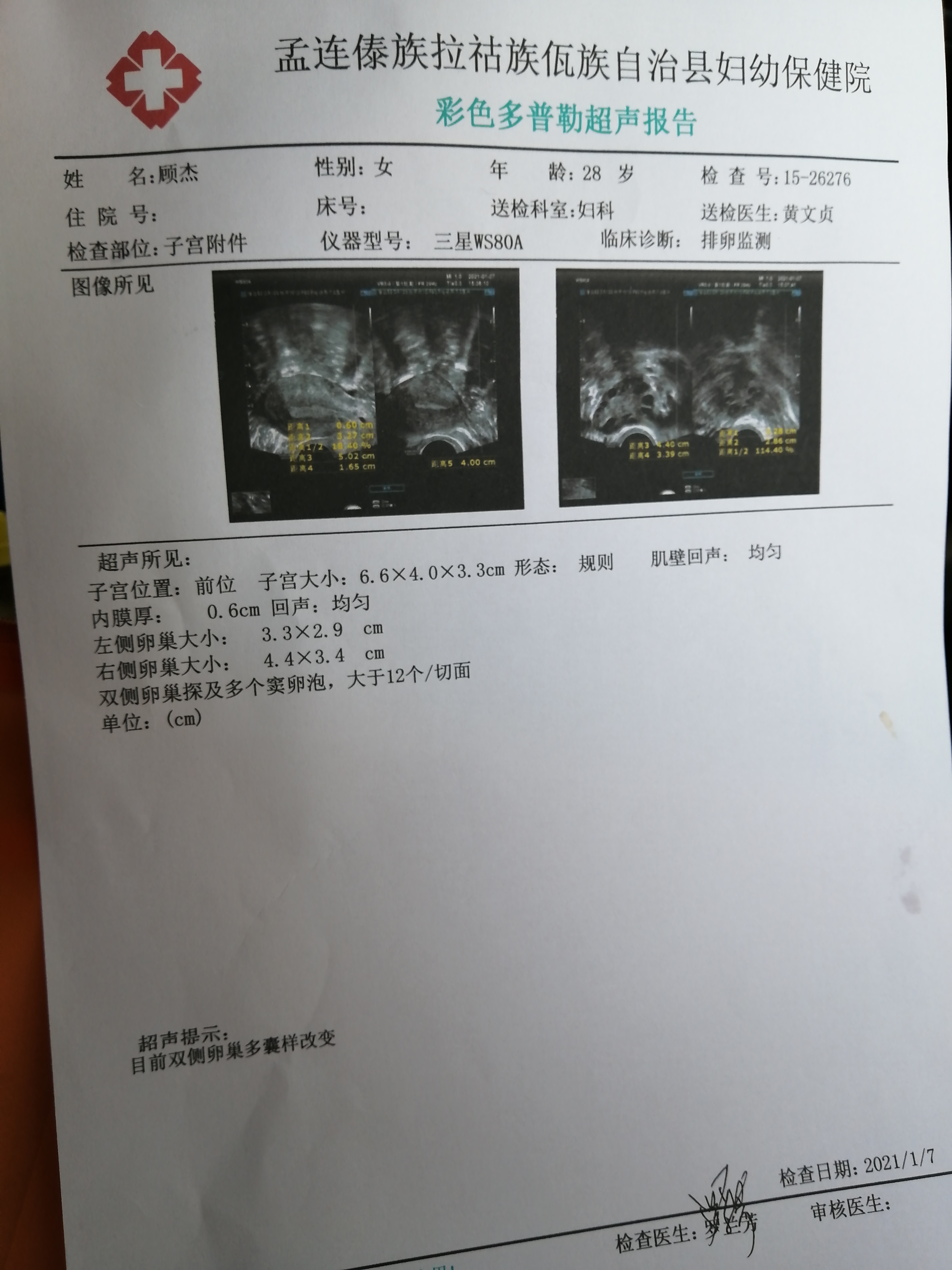 吃了9个月达英和二甲双胍上个月有一个优势卵泡