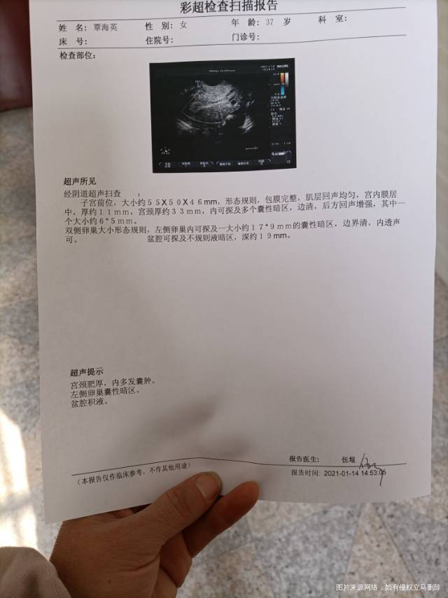 医生您好这个B超是流产40天做的不知道什么时