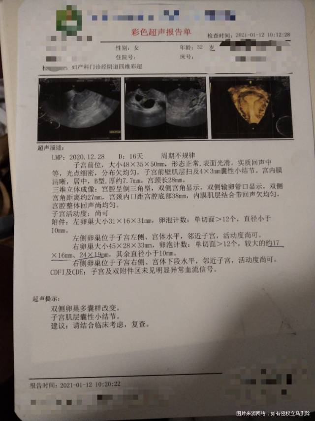 这是卵泡没排昨天做了B超然后打了6000单位