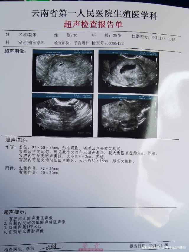 请问医生今天鲜胚移植第二十天血值正常吗14天
