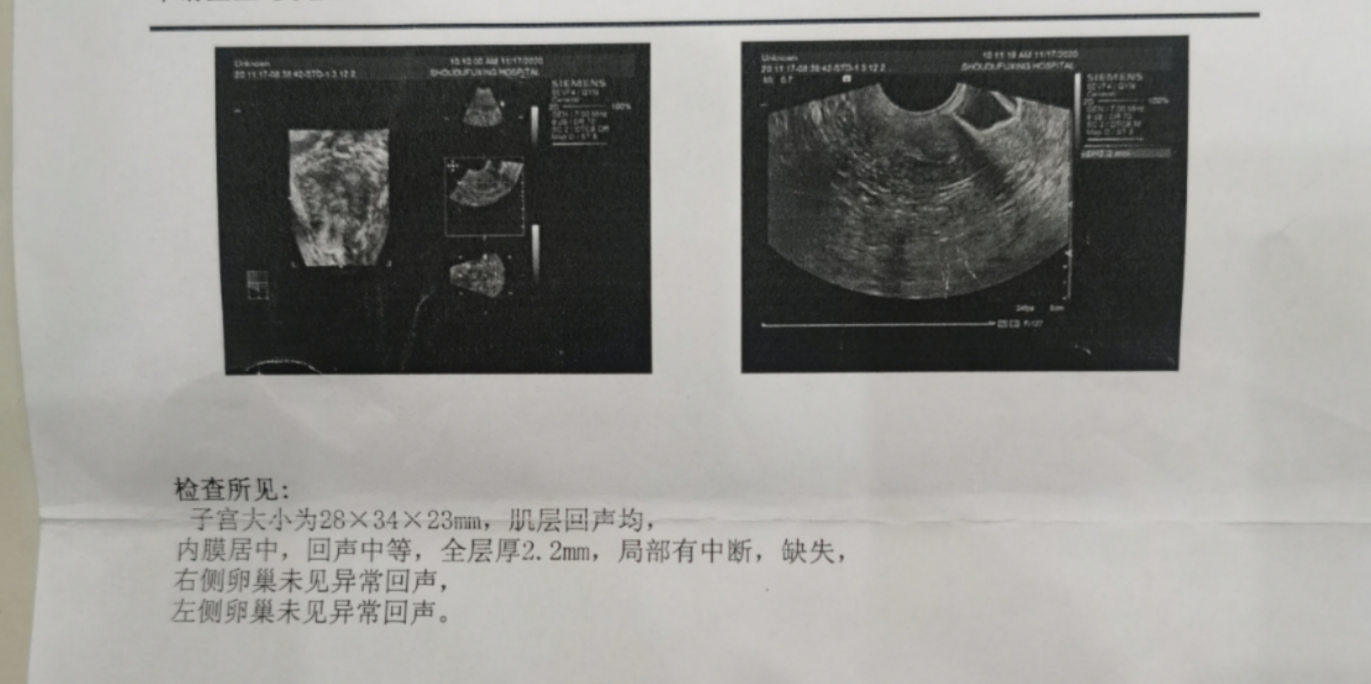 请问大夫我内膜特别的薄可以吃些什么有助于增长