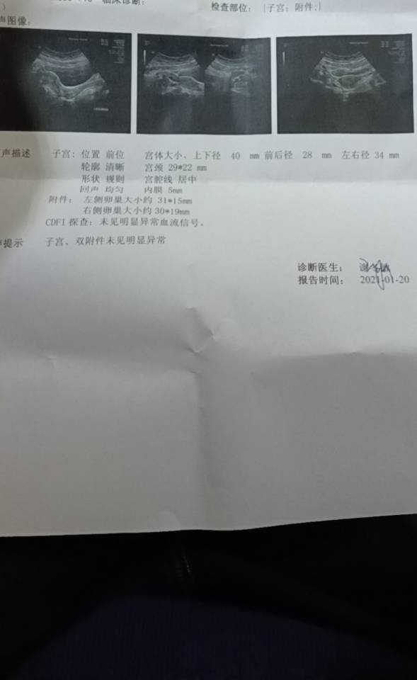 医生您好我今年20岁多囊目前体重126斤在三