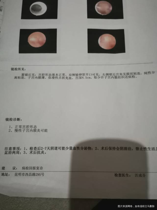 请问一下医生我这个是不是内膜炎是不是有病变