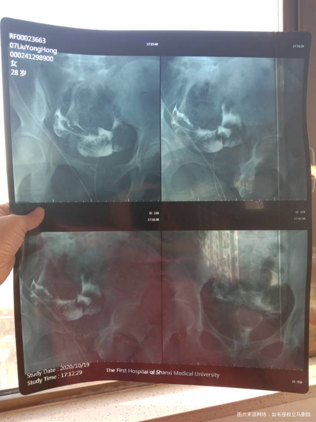 结婚5年一直检查原因不明就是怀孕怀不上不知道