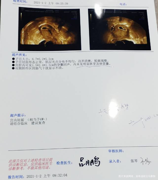 今天移植第37天医生建议保胎