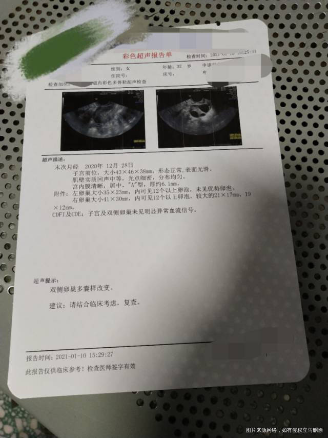 排卵期能剧烈运动吗能快走吗