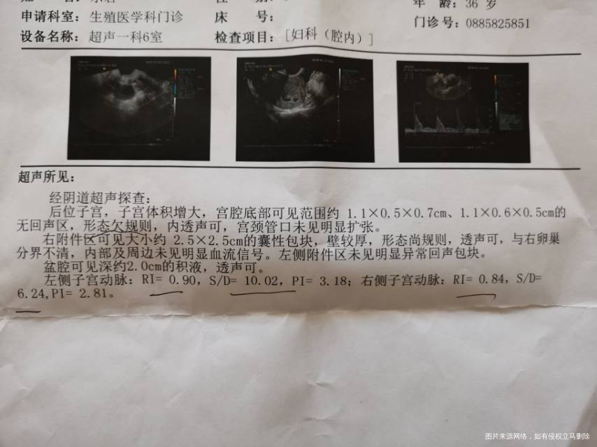 试管冻胚移植第20天阴超检查请问正常吗当天血