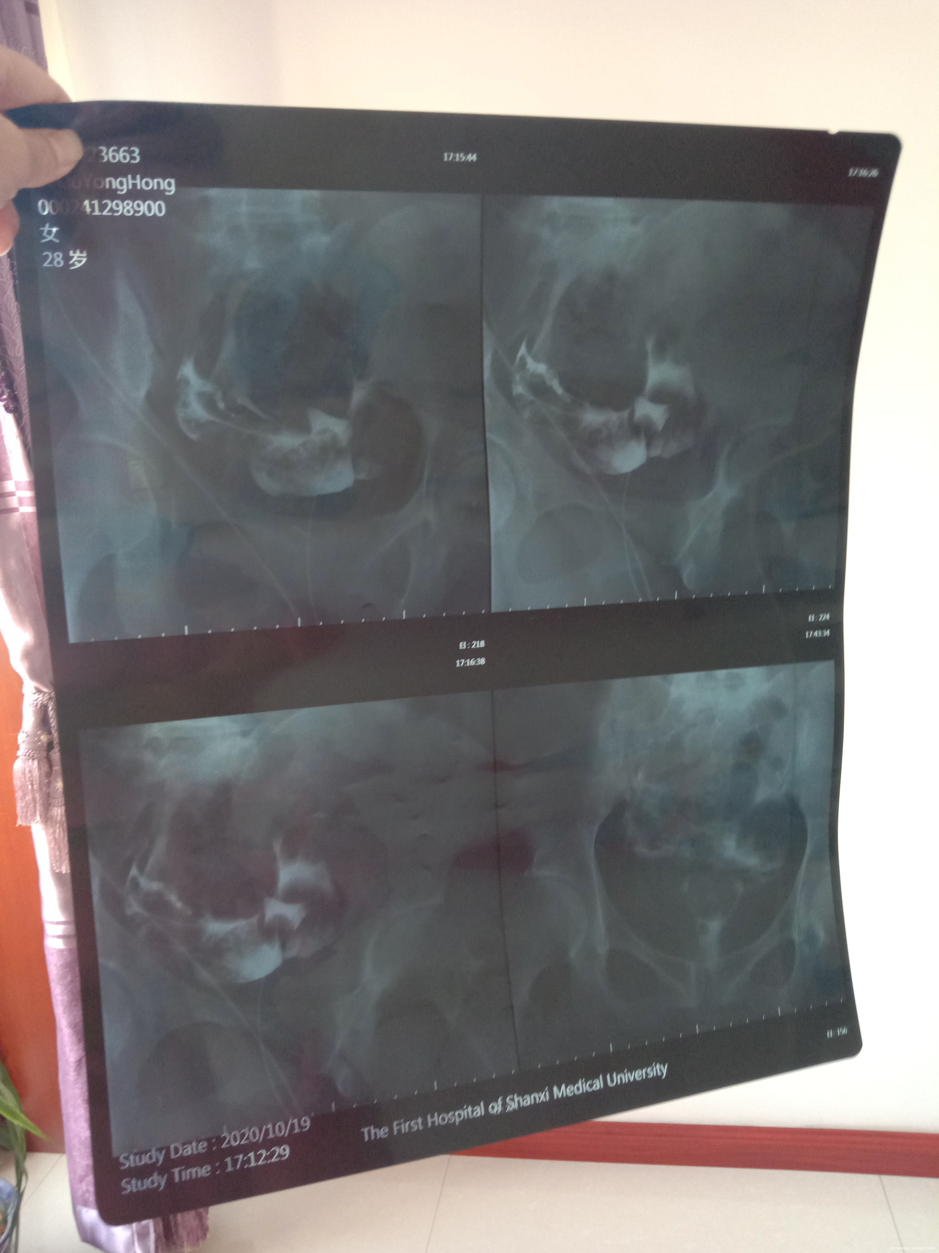 结婚5年一直检查原因不明就是怀孕怀不上不知道