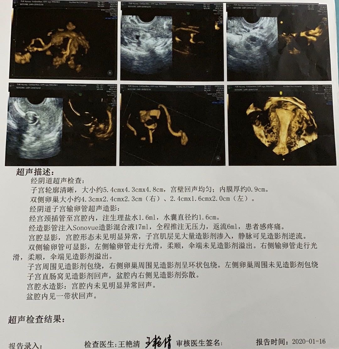 这个造影有问题吗超声造影会误诊吗