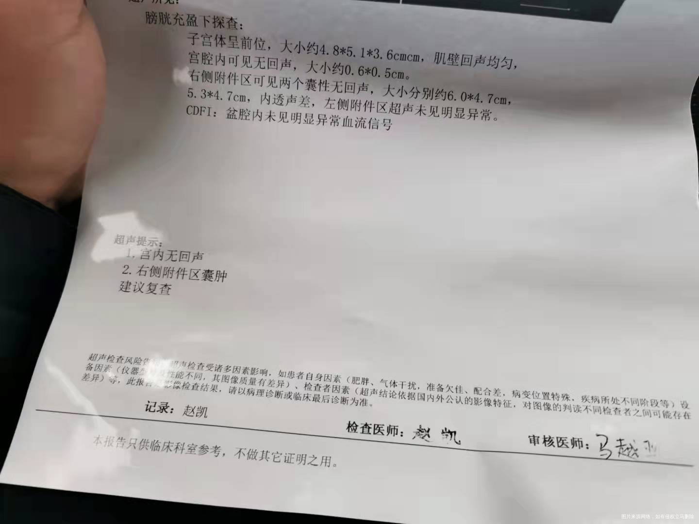 末次月经823号928做hcg36619昨天