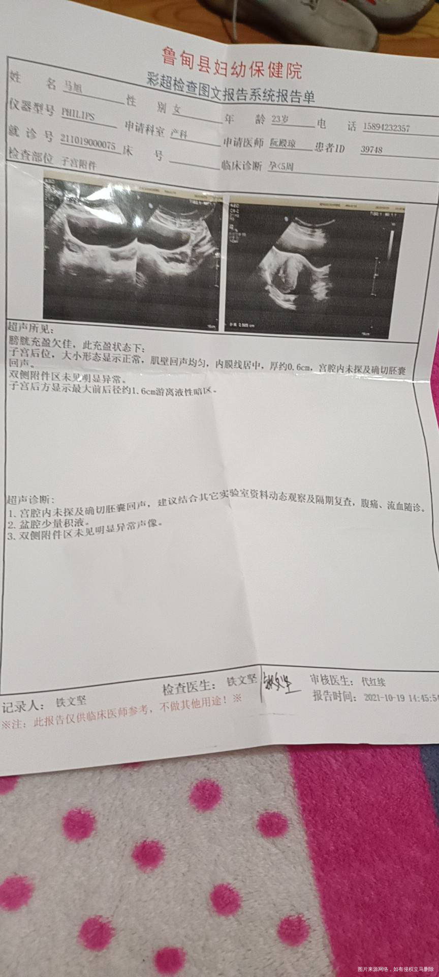 今天检查的单子流血了还能保住吗