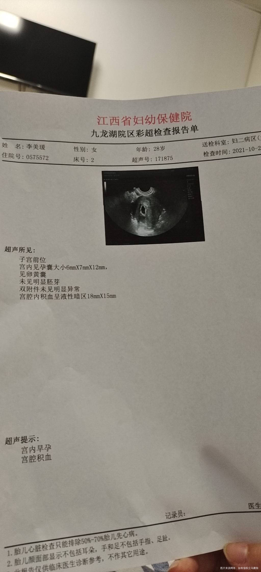 我是105日移植的一枚囊胚第十天hcg533