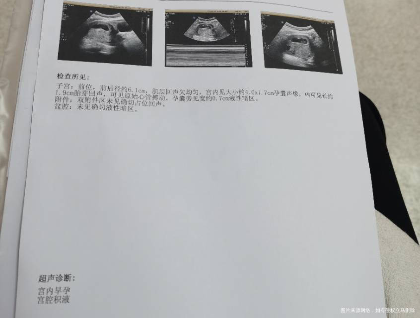 孕8周宫腔积液7mm胎心胎芽好昨天晚上出血鲜