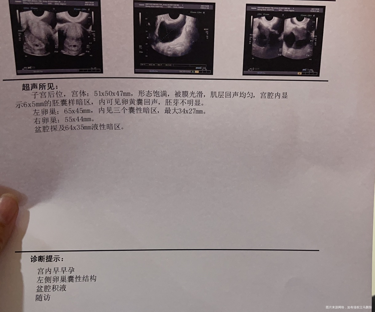 怀孕40天做阴超发现左侧有三个囊性暗区最大3