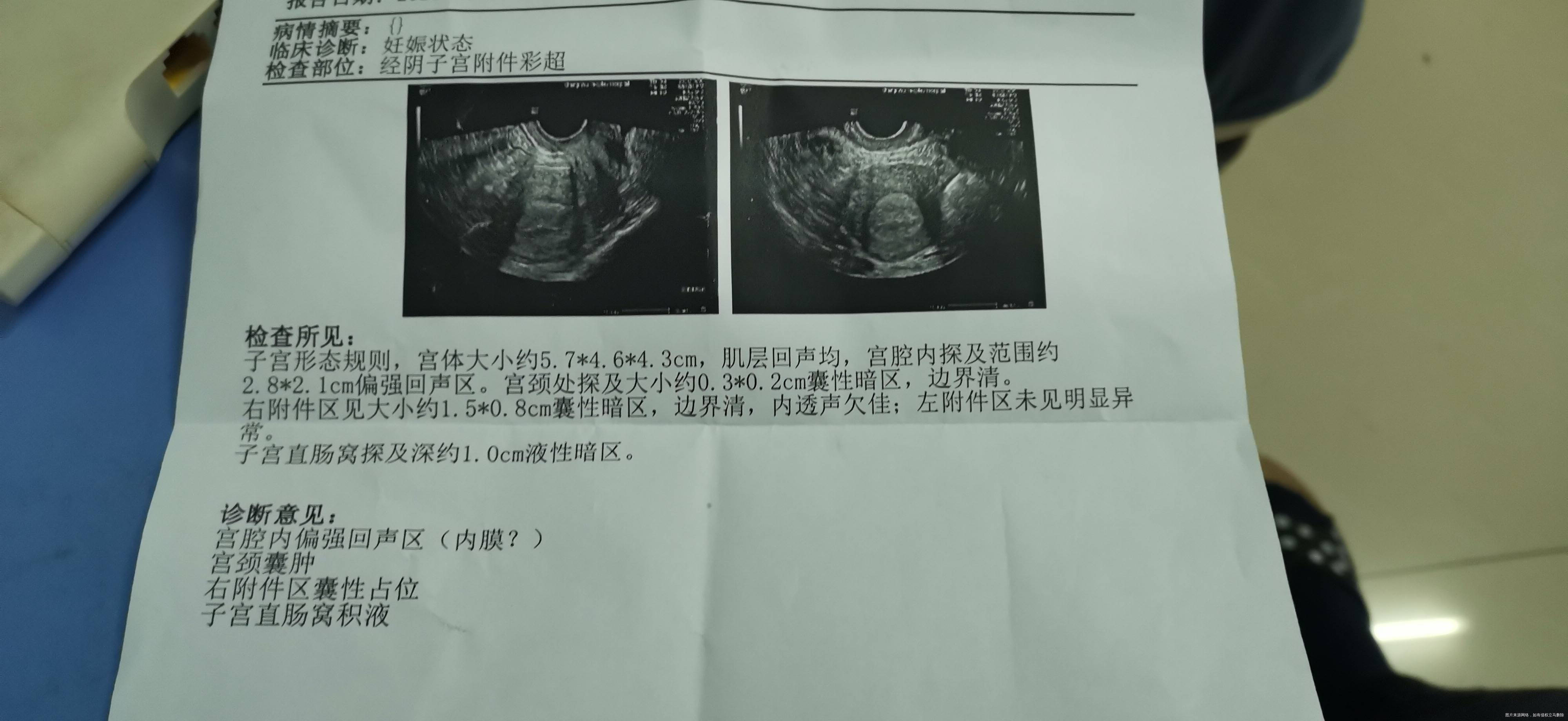 今天刚抽血说怀孕了我月经不规律经常49多天今