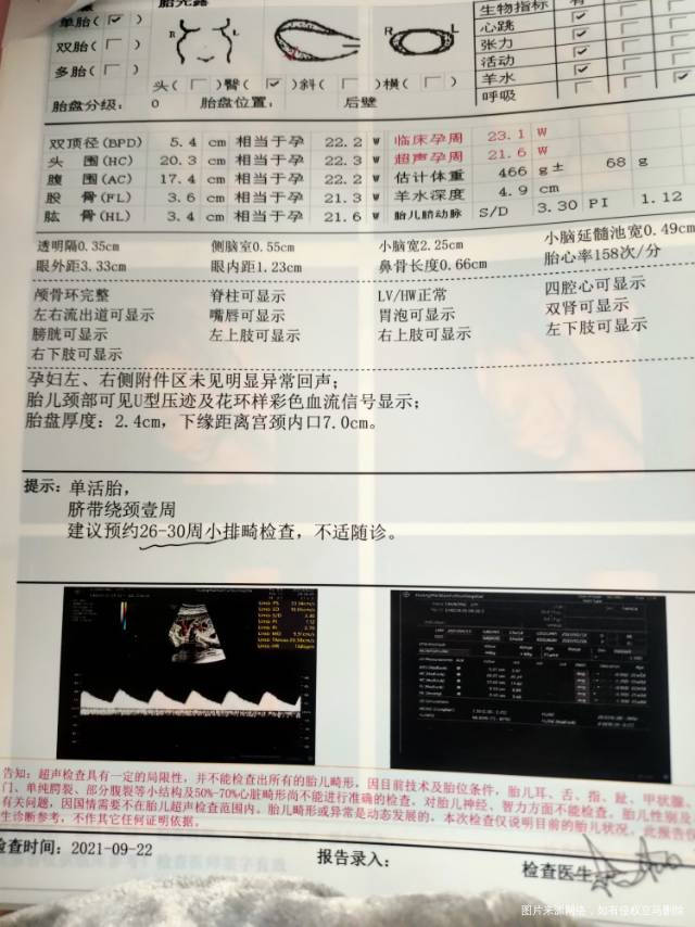 四维检查偏小问题大吗
