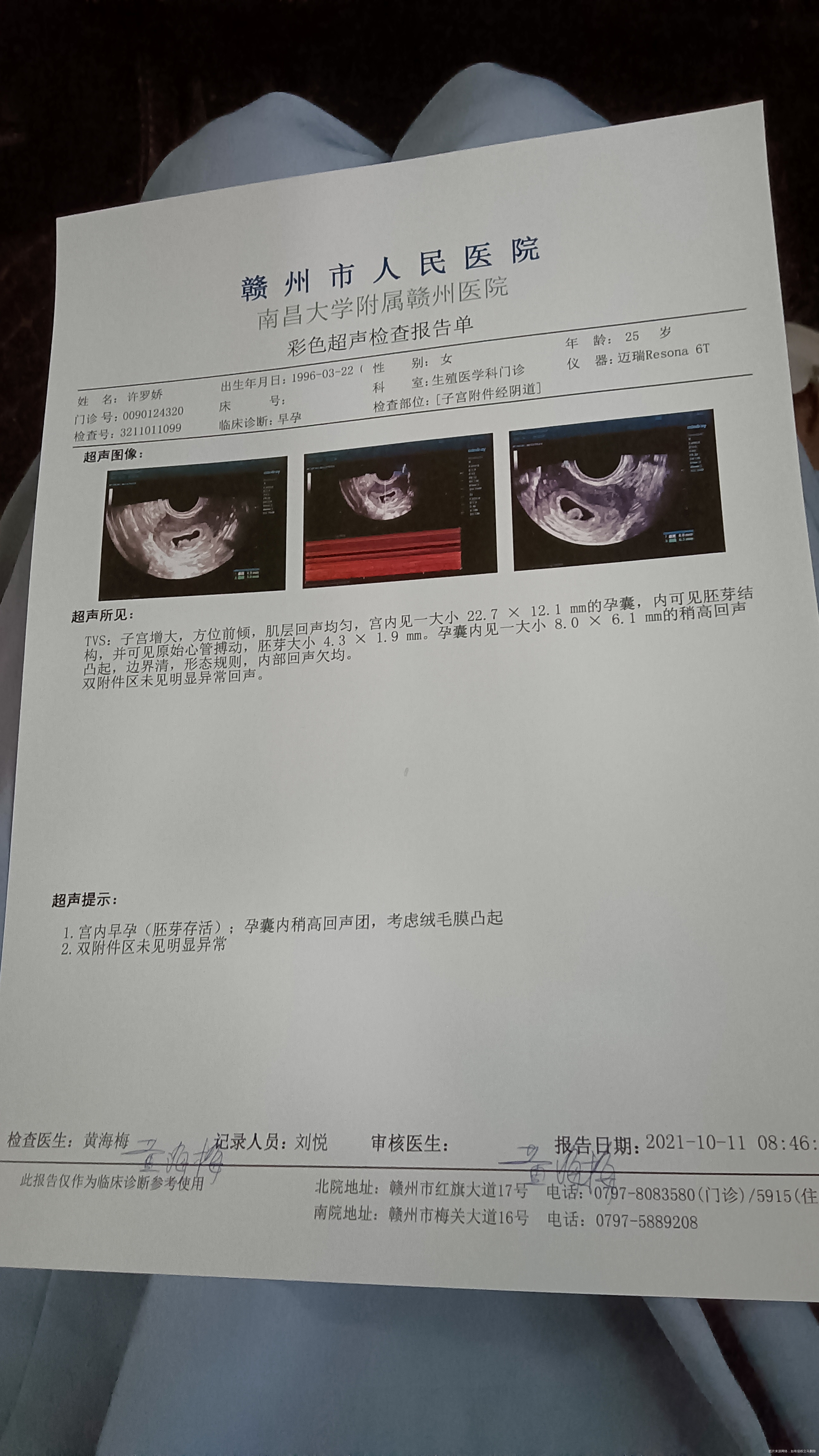 B超单上写绒毛膜凸起问题大吗做阴超的时候医生