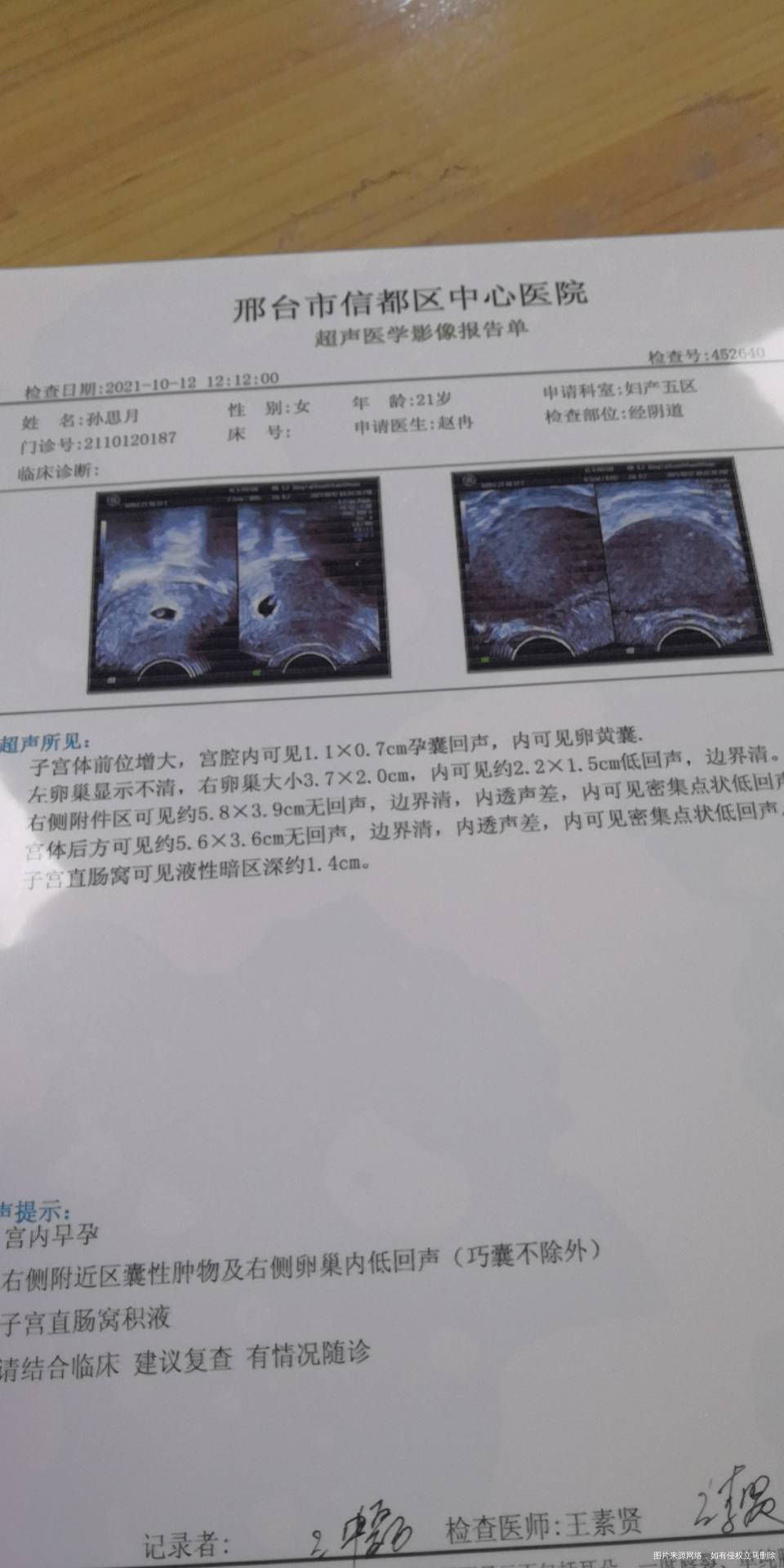 医生帮我看看孩子能保住吗