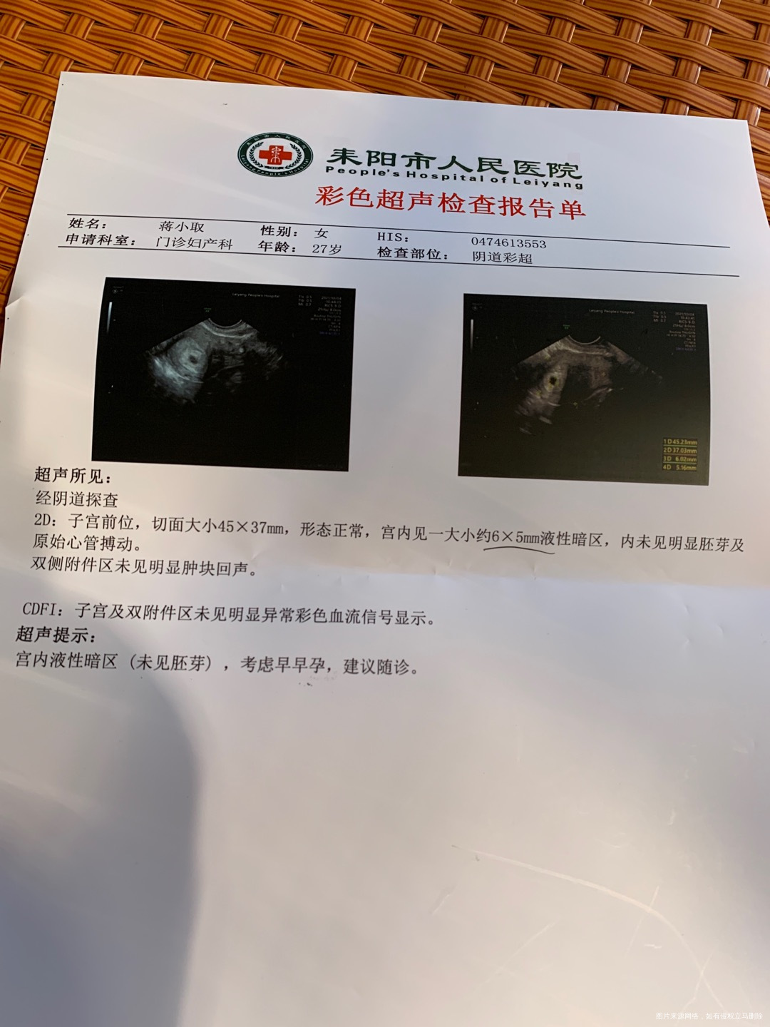 孕六周做了彩超这个结果正常吗