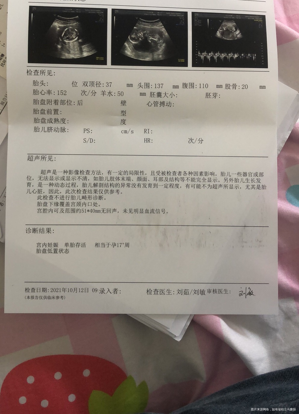 孕20周胎盘后壁下缘覆盖宫颈内口可以坐飞机吗