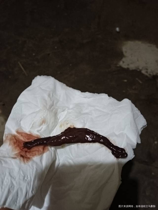 这个什么40多天的时候掉的