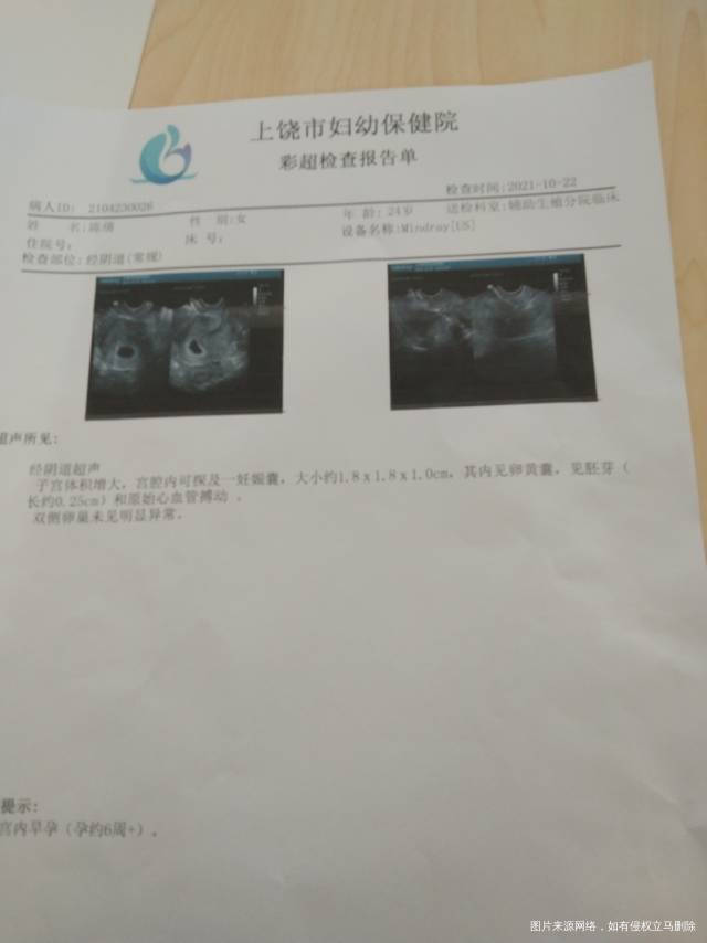 医生我宝宝这样好的吗?