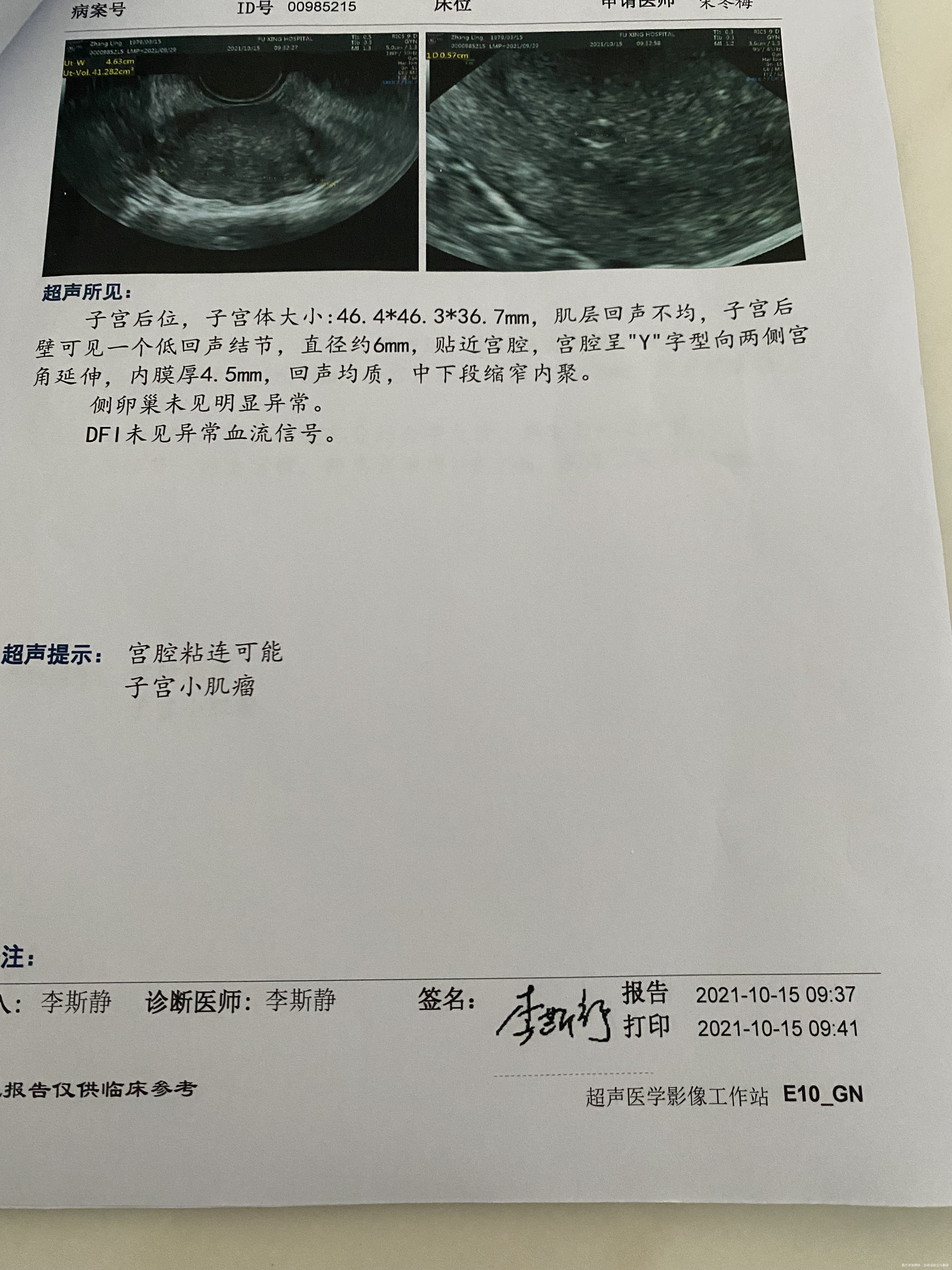 宫腔镜检查发现是宫腔粘连经三维彩超确诊同时提