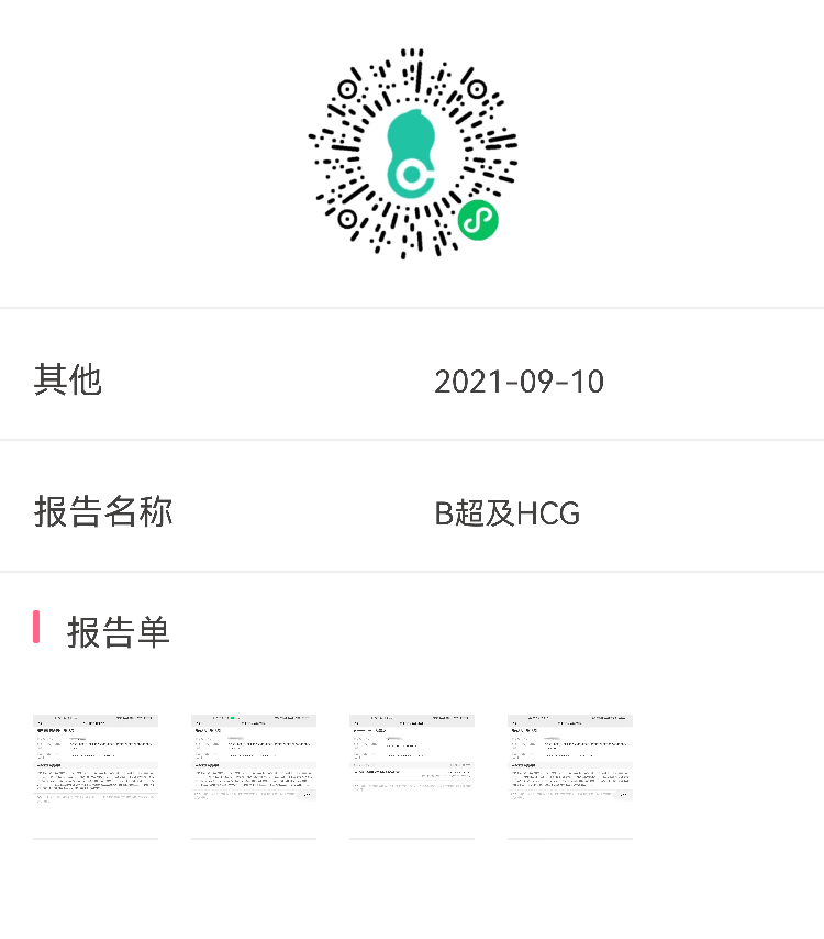 请问医生孕囊为什么变小了怀孕70多天正常吗