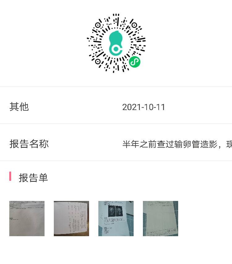 备孕两年没有怀孕半年之前查了输卵管造影现在忽