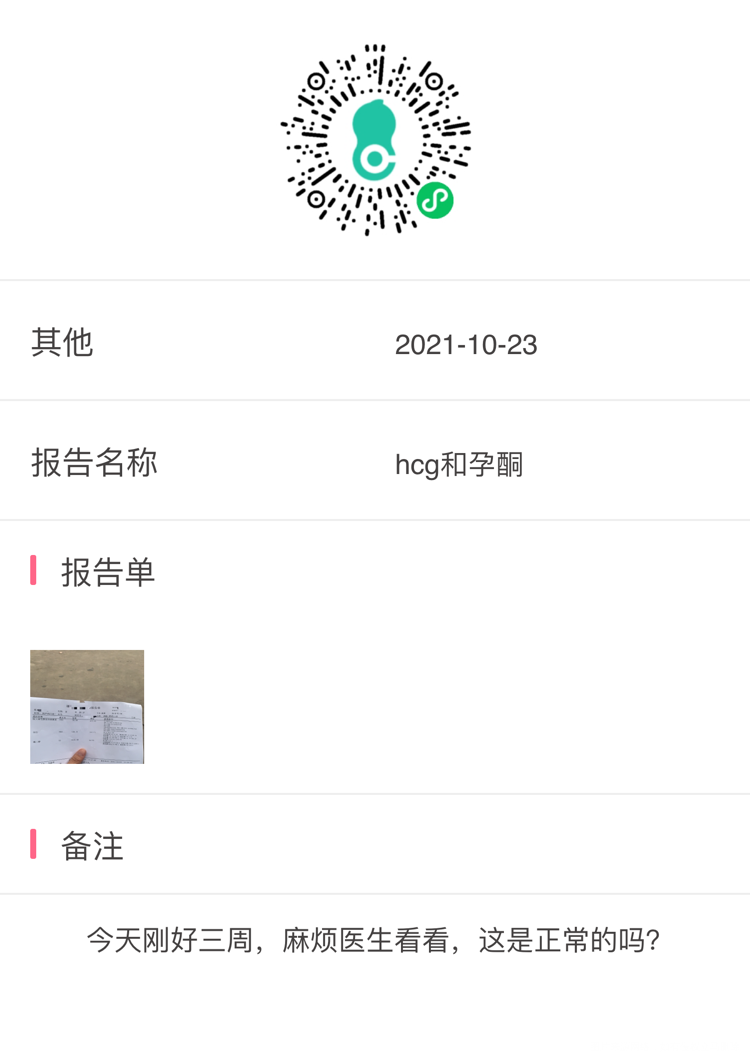 医生下午好我今天刚好三周hcg值正常吗