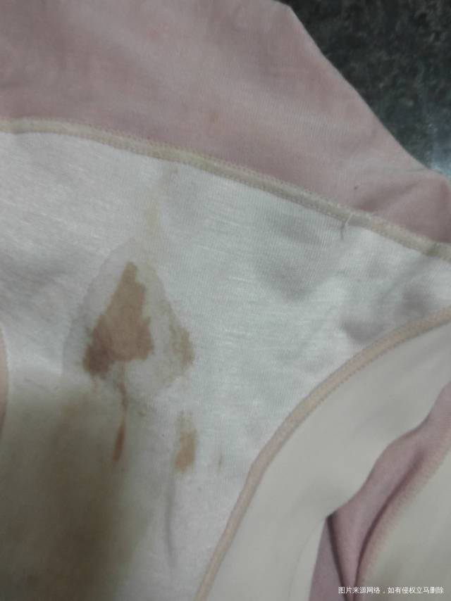 刚怀孕晚上上完大便看见内裤上出血了要不要紧需