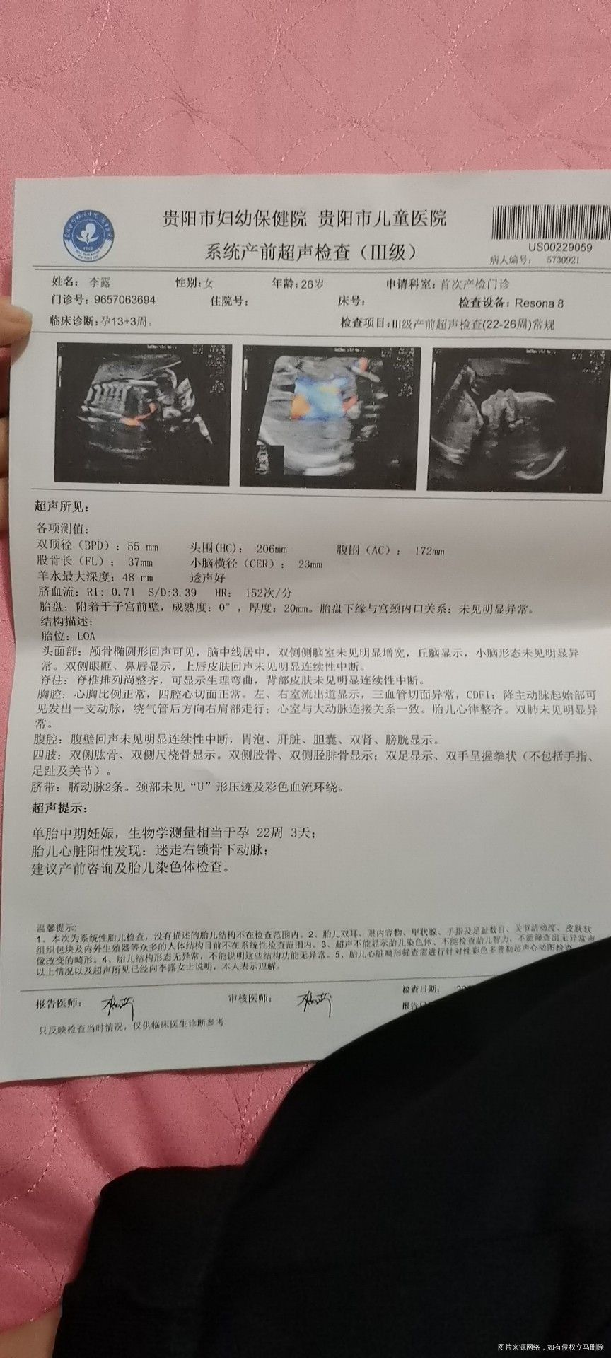 迷走右锁骨下动脉严重吗需要做羊水穿刺吗