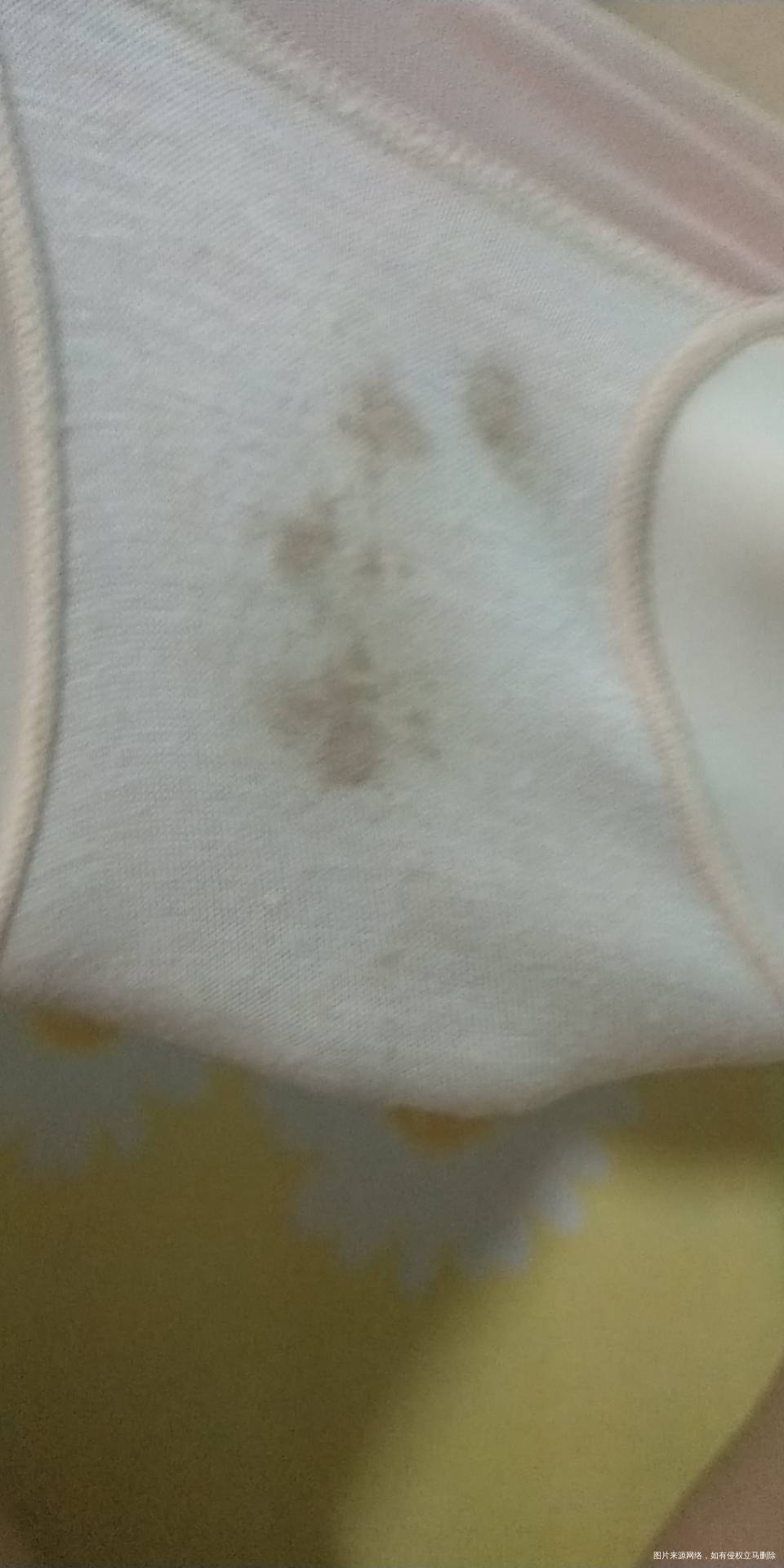 昨天去查的hcg翻倍刚刚发现内裤有点褐色分泌