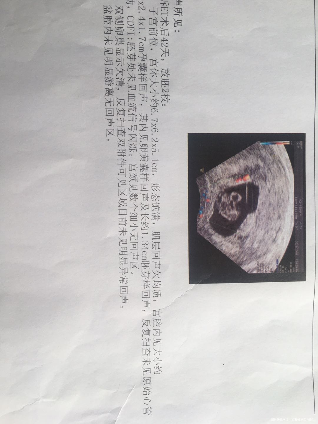 请问我这种情况还能保胎吗