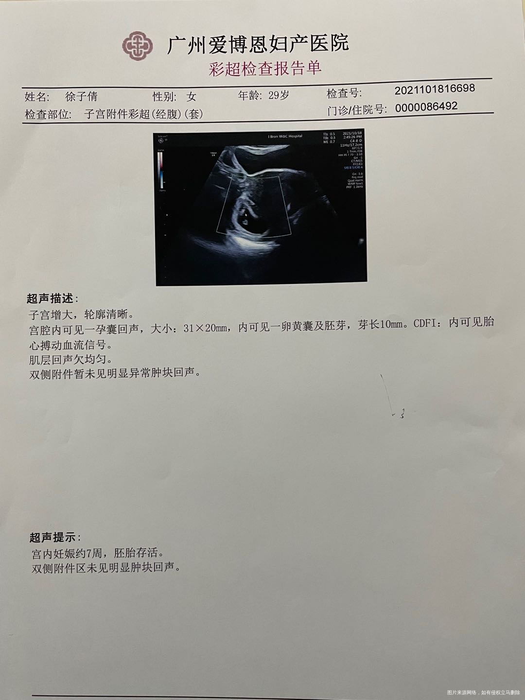 1018号7+1周胚芽10mm今天1030号