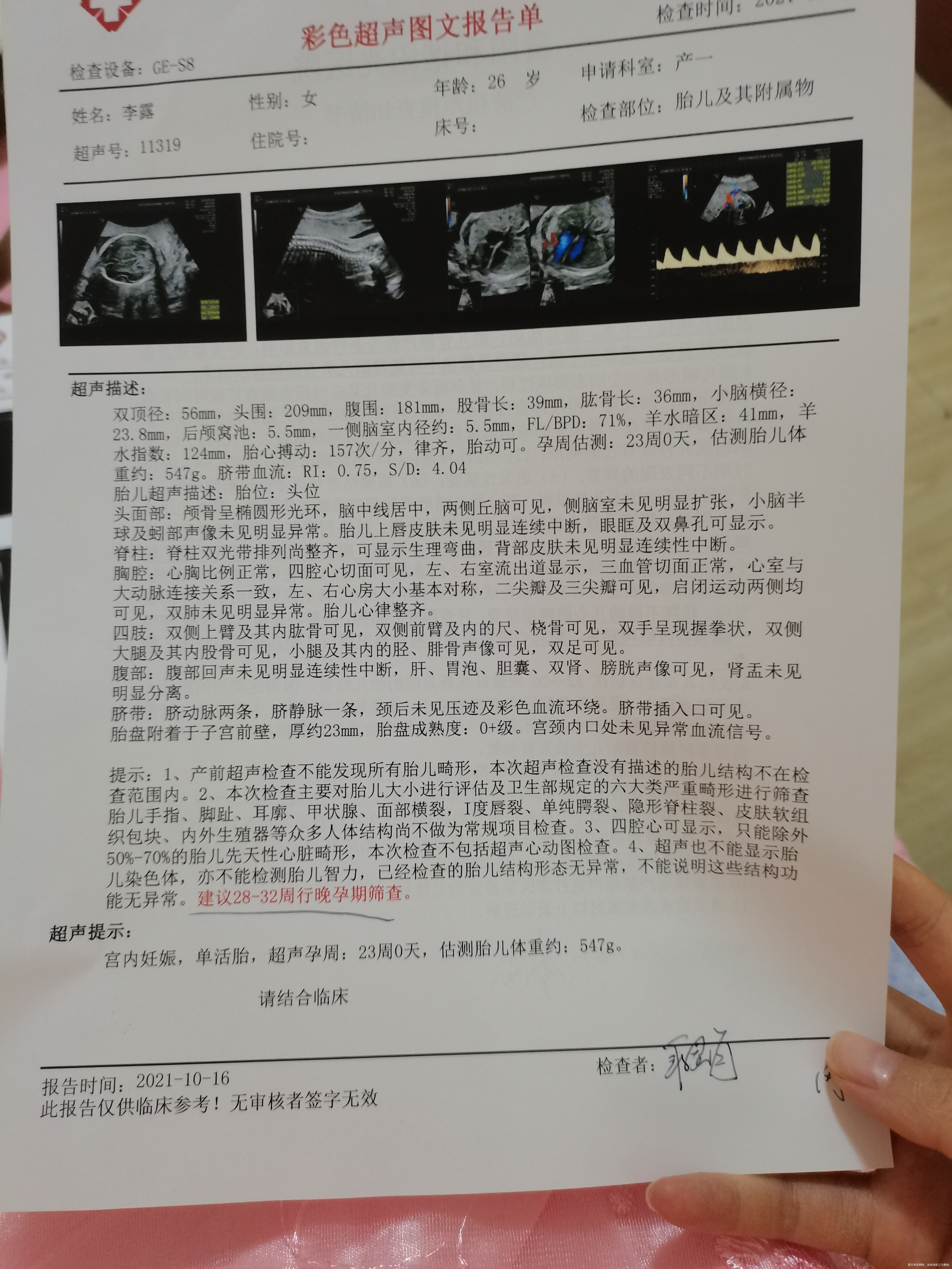 迷走右锁骨下动脉严重吗需要做羊水穿刺吗