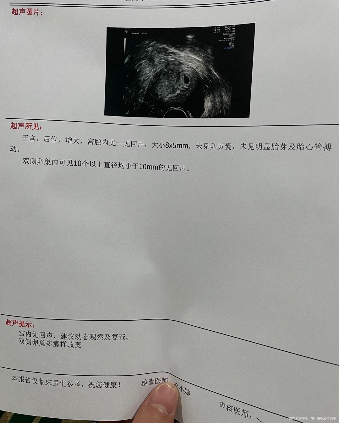 请问这个是宫内孕的意思吗为什么b超医生说宫内