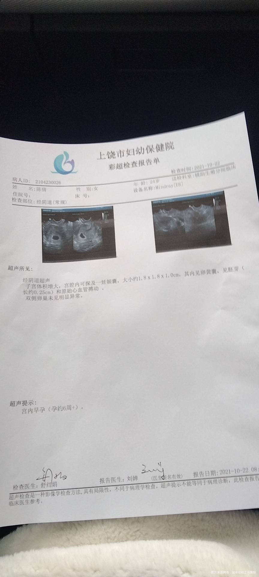 医生孕6周左右胎芽会小吗