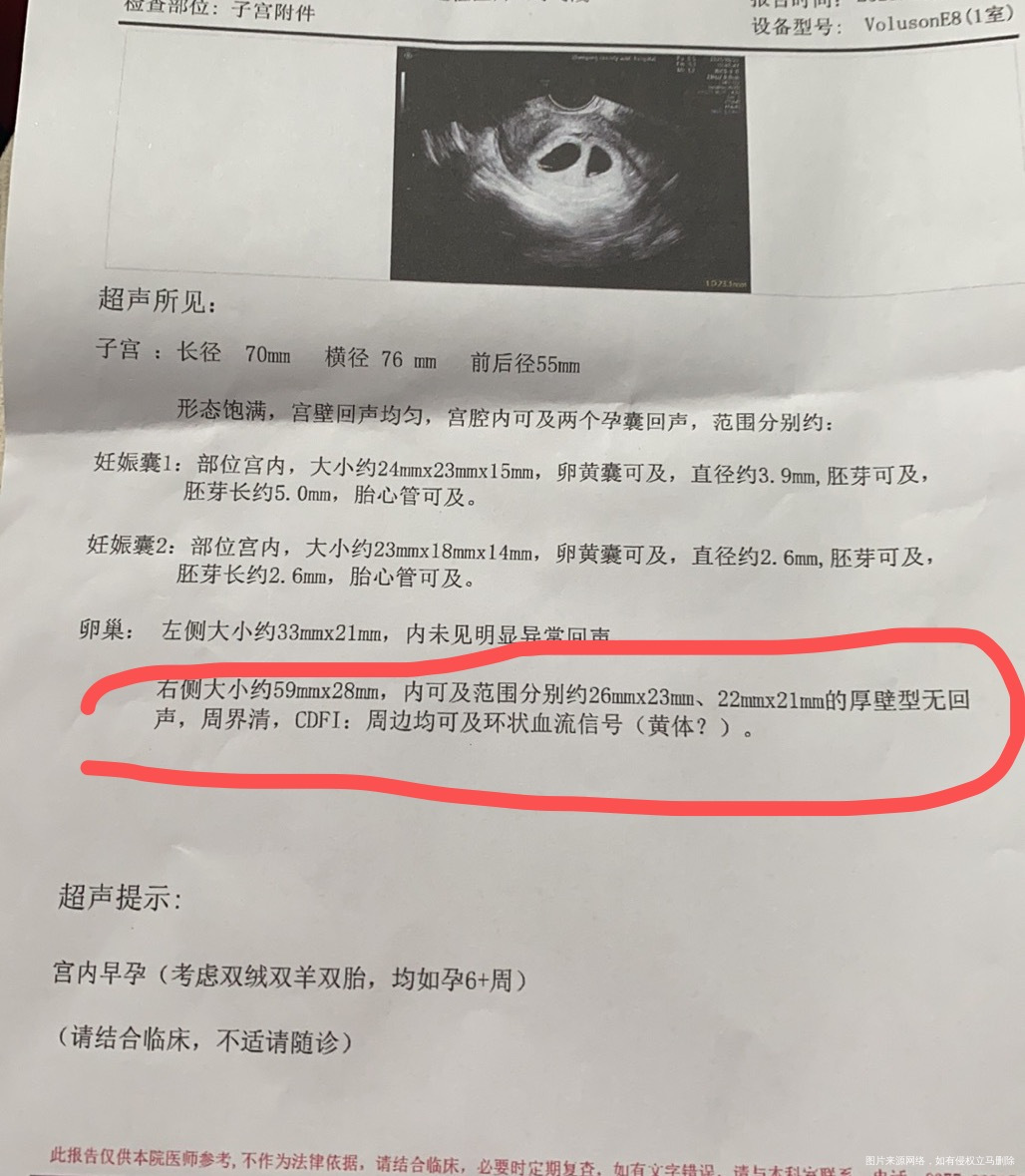 医生今天6周➕3天阴超卵巢右侧有什么问题吗