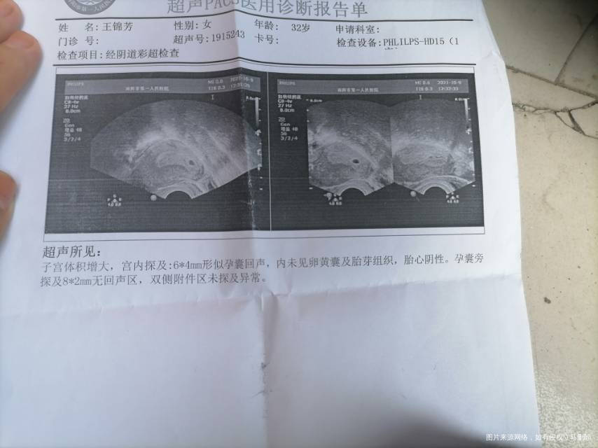 形似孕囊6mm4mm有回声还有希望吗